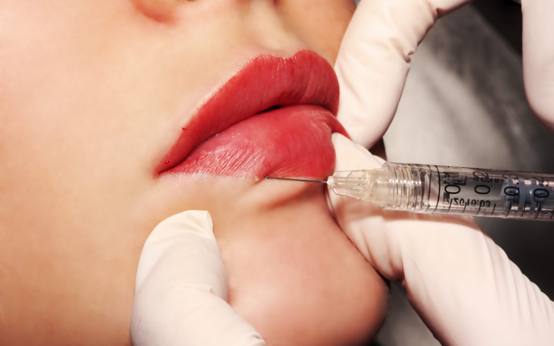 Your guide to fillers in Charlotte, NC