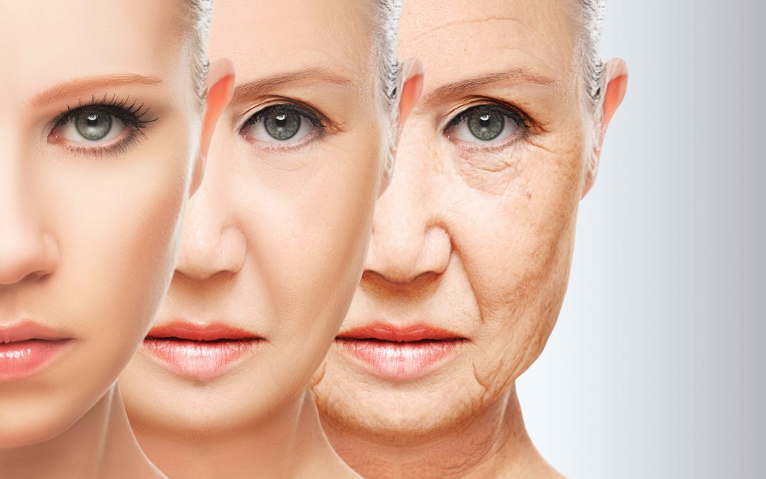 Fractional resurfacing reduces the appearance of wrinkles in Charlotte, NC