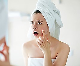 Acne treatment by the best dermatologist in Charlotte, NC